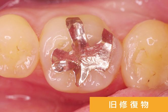 治療スタート