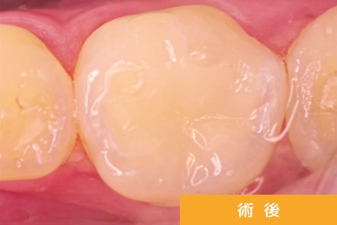 治療完了
